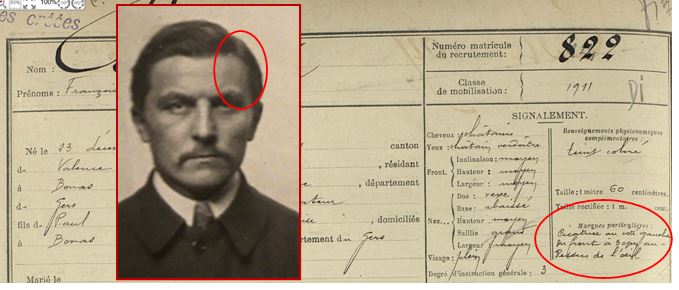 dumont cicatrice b.JPG